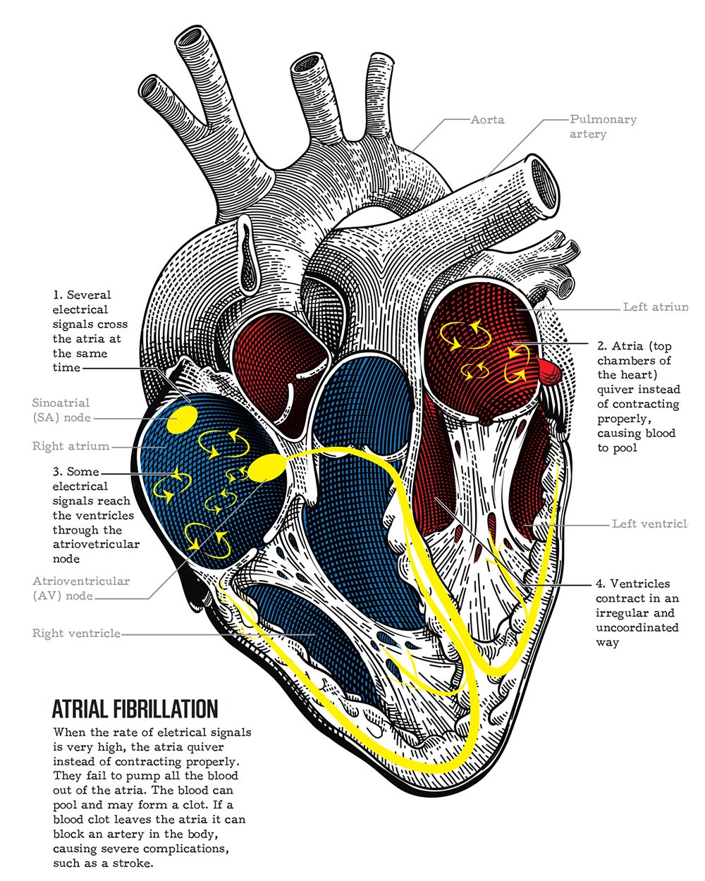 Cycling to extremes: Heart health and endurance sports - Velo