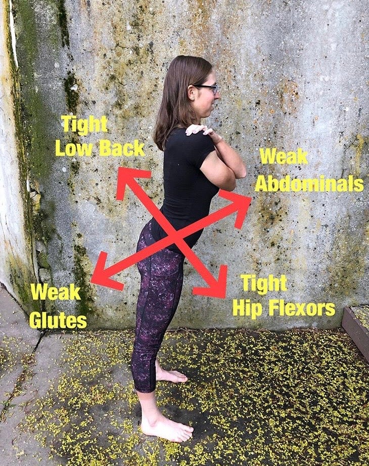 Tight hip flexors discount lower back pain