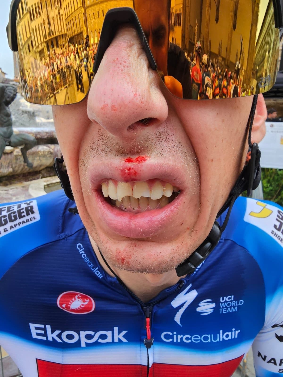 Tour de France: Hirt Breaks Three Teeth in Pre-Stage Crash