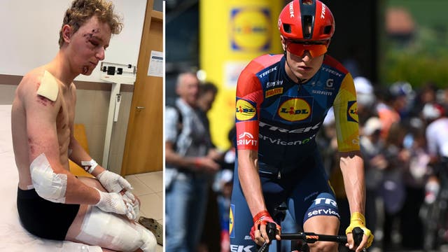 Injuries So Terrible the Clinic Ran Out of Bandages: Teen Talent Reveals Toll of 80KPH Training Crash