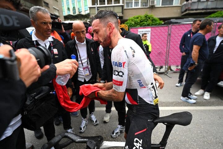 Adam Yates was cut up following his stage 2 crash. His concussion became evident later (Photo: Tim de Waele/Getty Images)