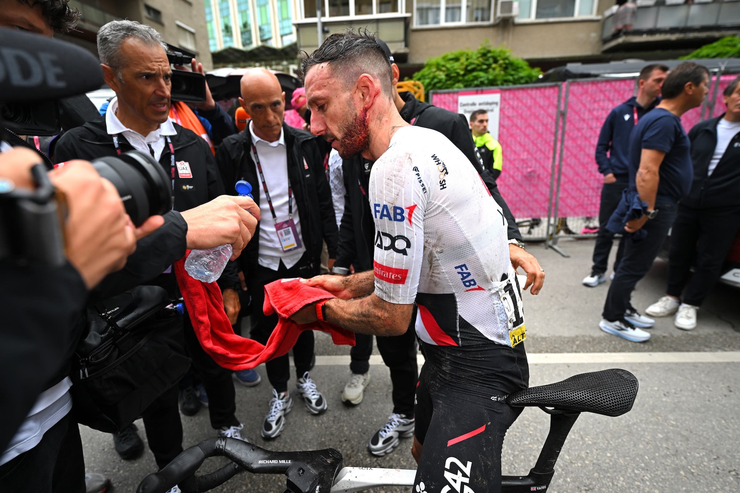 Adam Yates was cut up following his stage 2 crash. His concussion became evident later (Photo: Tim de Waele/Getty Images)
