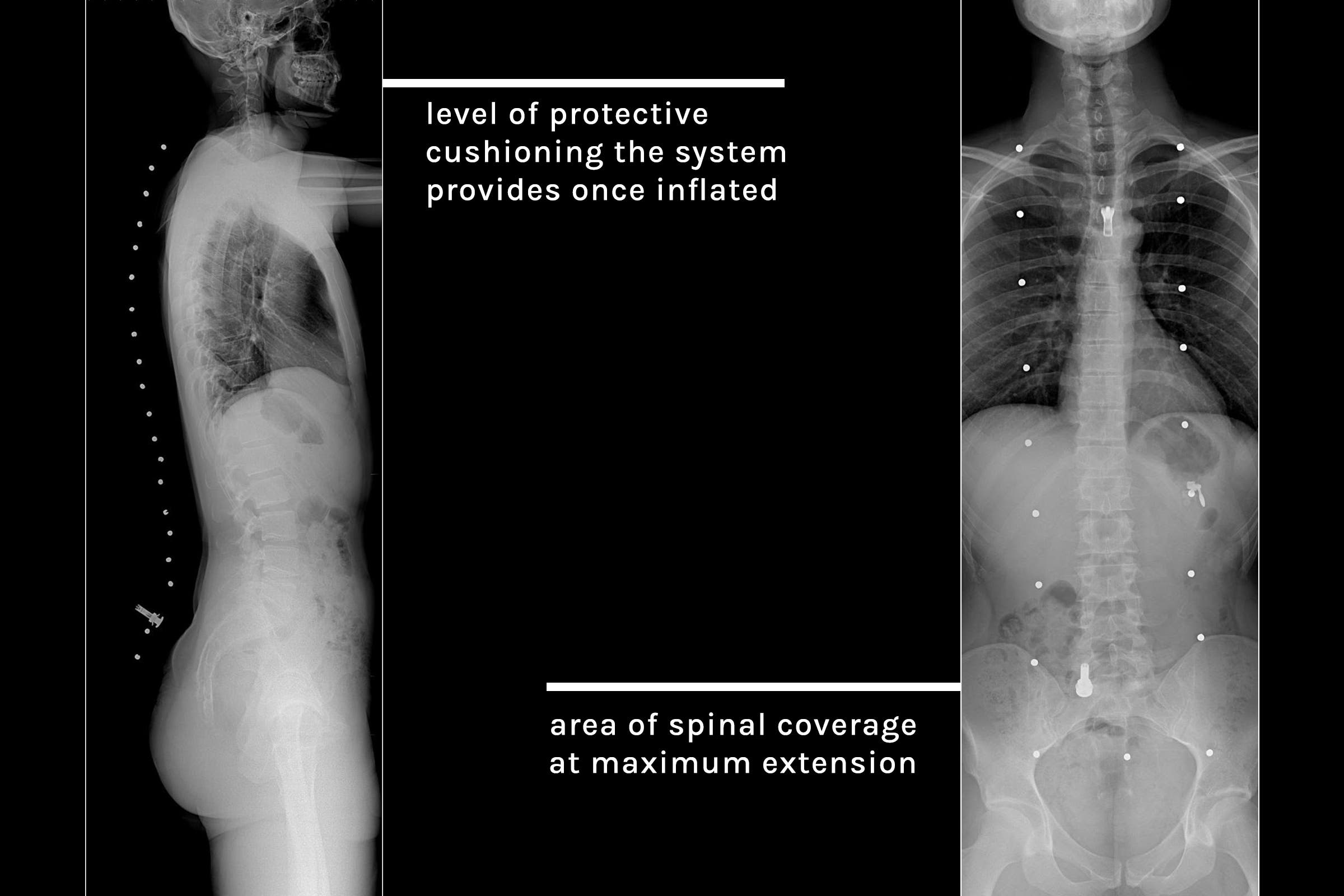 Castelli xray airbag image