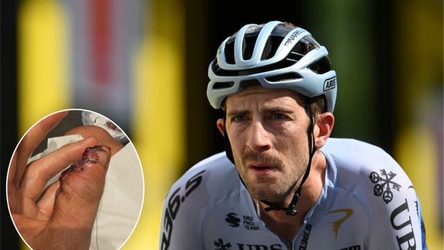 Chris Harper Loses Part of Thumb in Gruesome Tour de France Crash