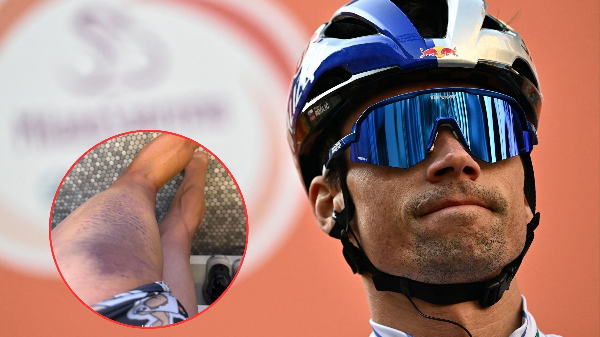 Primož Roglič Hit by Car, Throwing Vuelta a España Preparations Into Chaos