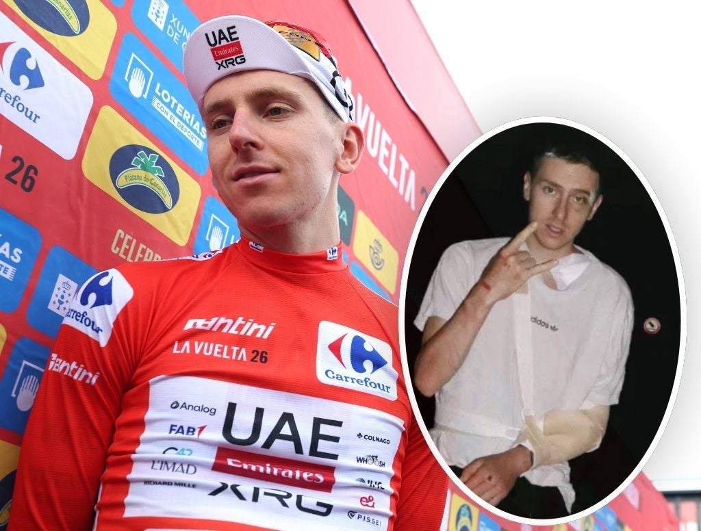 Tadej Pogačar Remains Optimistic After Vuelta Crash
